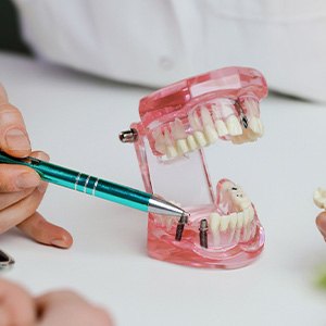 Dentist pointing to model of dental implant