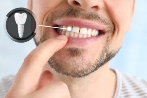 Man smiling and pointing to his dental implant