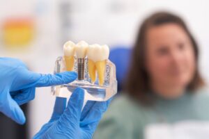 Gloved hands pointing to sample dental implant with patient blurry in background
